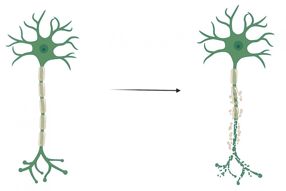 Understanding Neurons & the Myelin Sheath in Charcot-Marie-Tooth ...