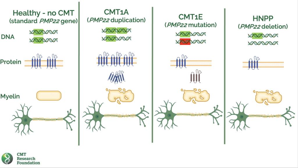 Healthy nerves and types of CMT1 disease